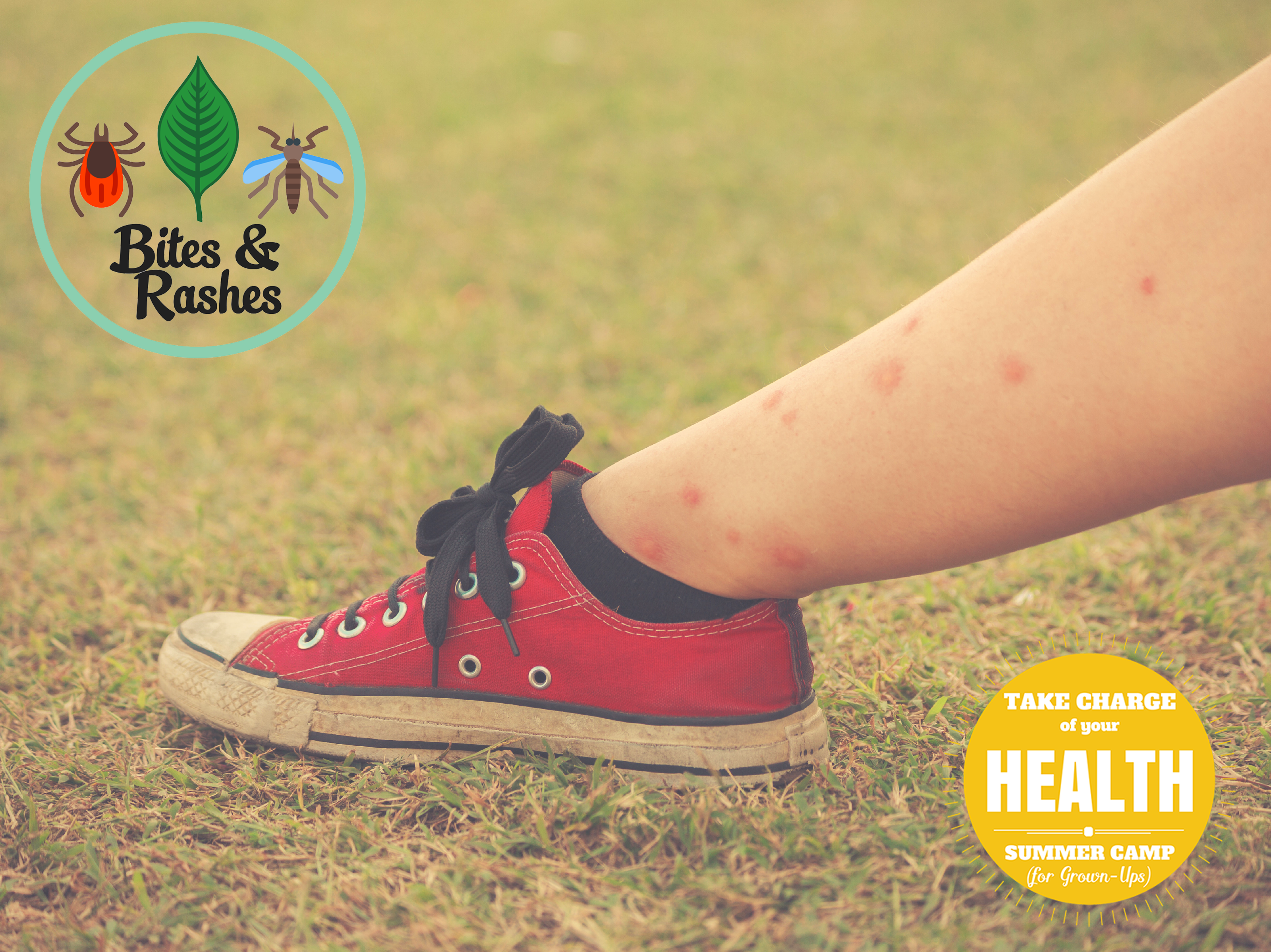 Summer Camp Week 4: Bites and Rashes